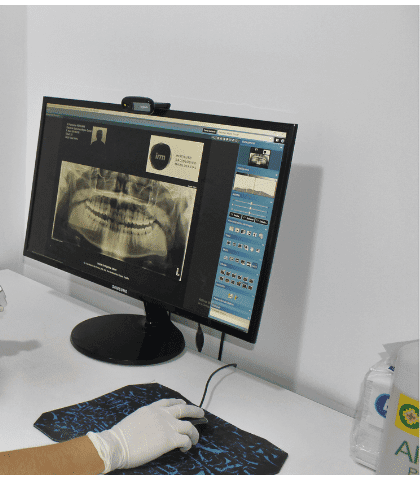 Plataforma IRM mostrando radiografía panorámica